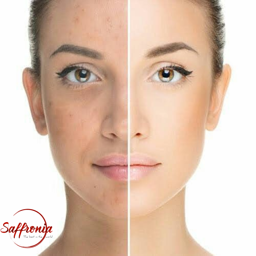 Before and after comparison of a woman's face with visible skin texture on the left and smooth skin on the right, branded 'Saffronia'.